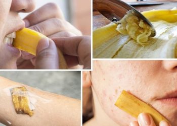 Réfléchissez deux fois avant de jeter les peaux de bananes : 12 façons de les utiliser