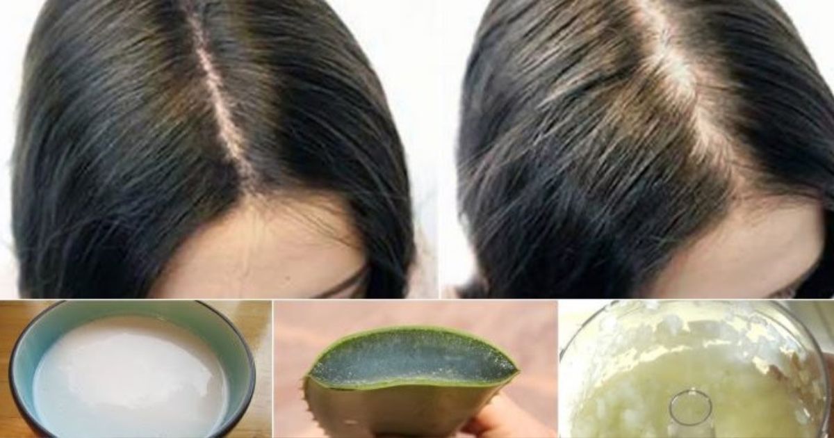 Six techniques naturelles pour faire pousser ses cheveux plus vite