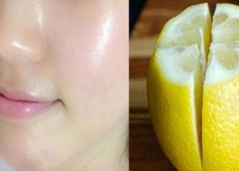 Utilisez du citron pour enlever les taches sur votre visage et avoir une peau éclatante en deux jours