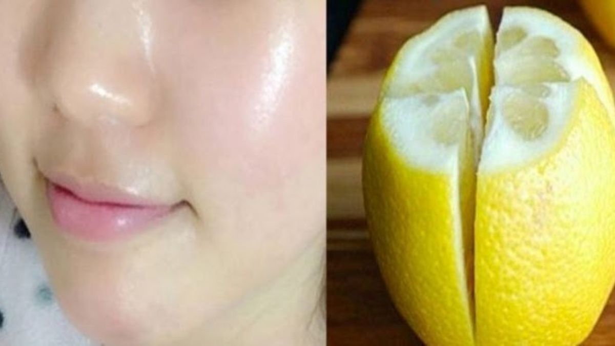 Utilisez du citron pour enlever les taches sur votre visage et avoir une peau éclatante en deux jours
