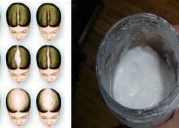 Voici comment utiliser le bicarbonate de soude pour faire repousser vos cheveux