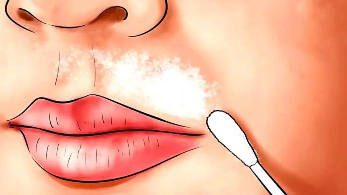 Comment éliminer les poils du visage avec du bicarbonate de soude