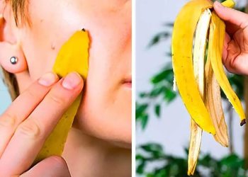 Pourquoi faut-il se frotter la peau de banane sur le visage une fois par semaine ?