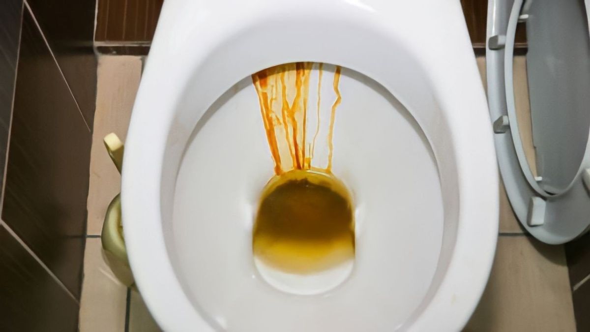Comment éliminer les taches marrons des toilettes