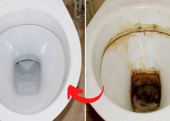 Enlever le calcaire dans les toilettes : astuces et solutions